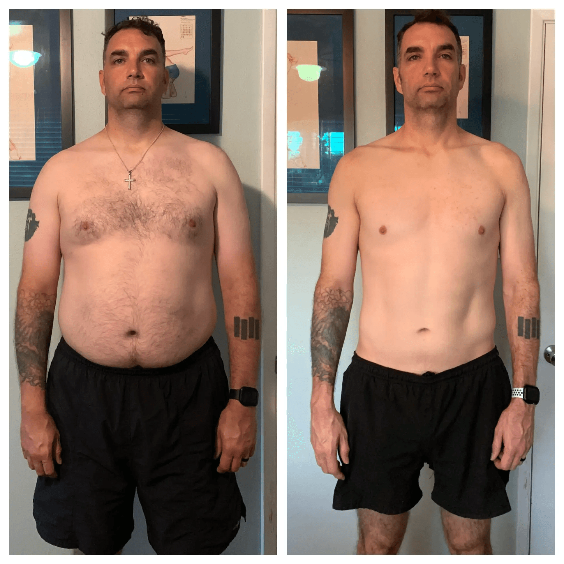 James before treatment